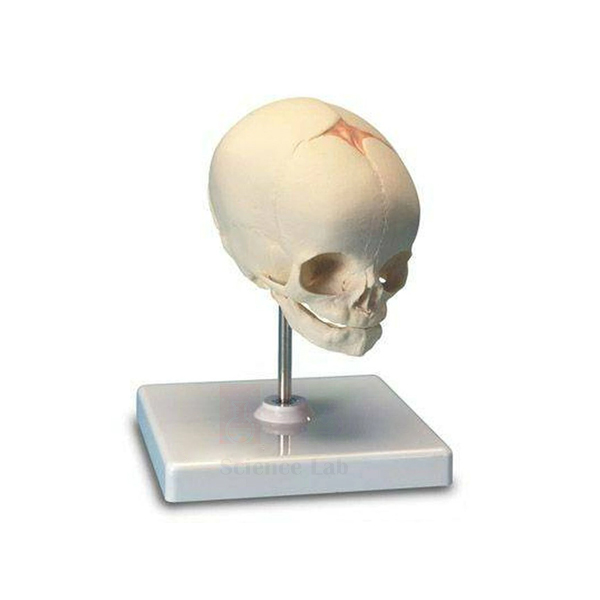 Fetal Skull